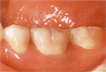 �P����after