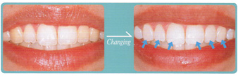 ���R�Ȏ�����蔒��before��after