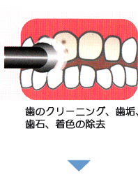 ���̃N���[�j���O�A���C�A���΁A���F�̏���
