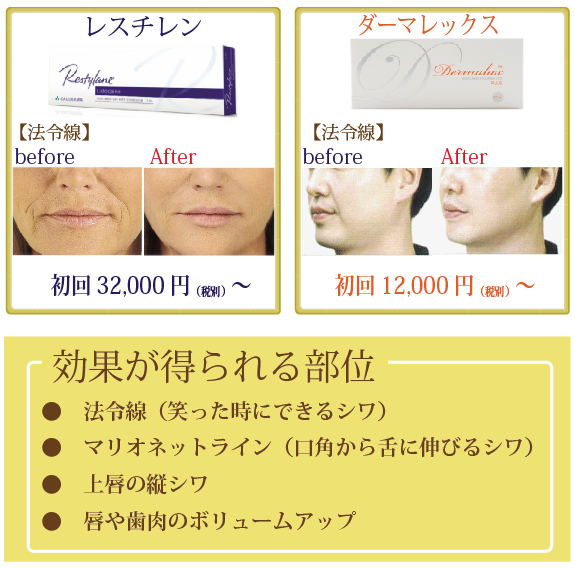 ヒアルロン酸