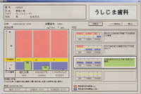 口臭測定器オーラルクロマ