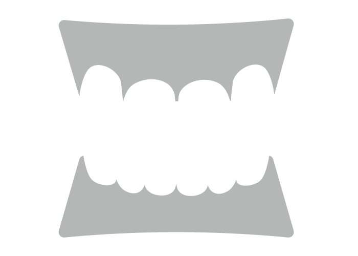 上下の噛み合わせが悪い（出っ歯・受け口など）