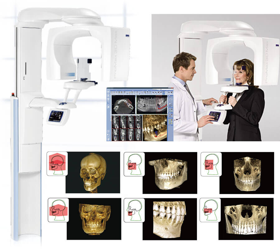 歯科用CT機器