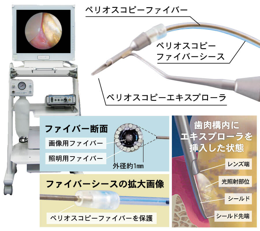 ペリオスコピーシステム