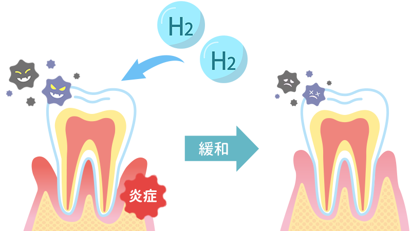 歯周病の緩和
