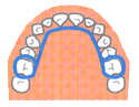 リンガルアーチ