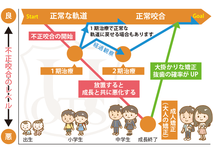 小児矯正歯科の治療の流れ