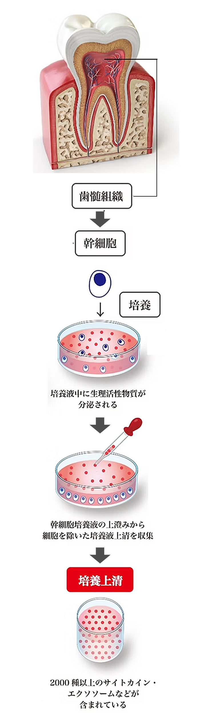 歯髄幹細胞上清液