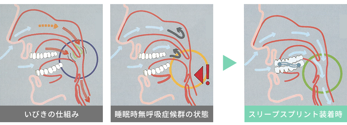 スリープスプリントの仕組み