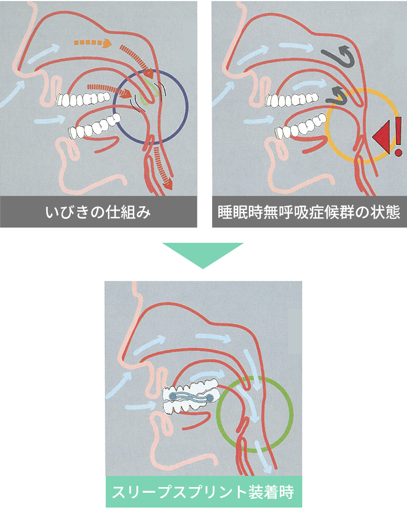 スリープスプリントの仕組み