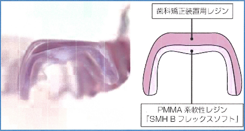 二層構造