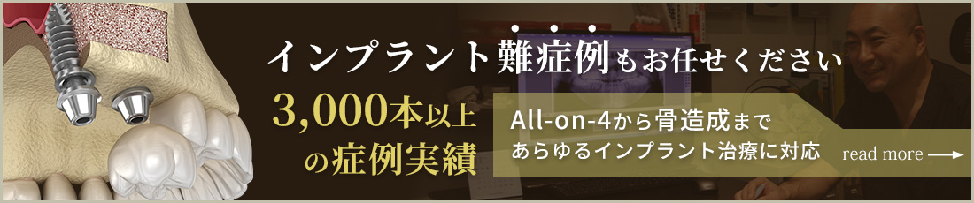 神戸 インプラント
