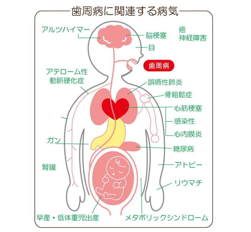 歯周病と全身疾患