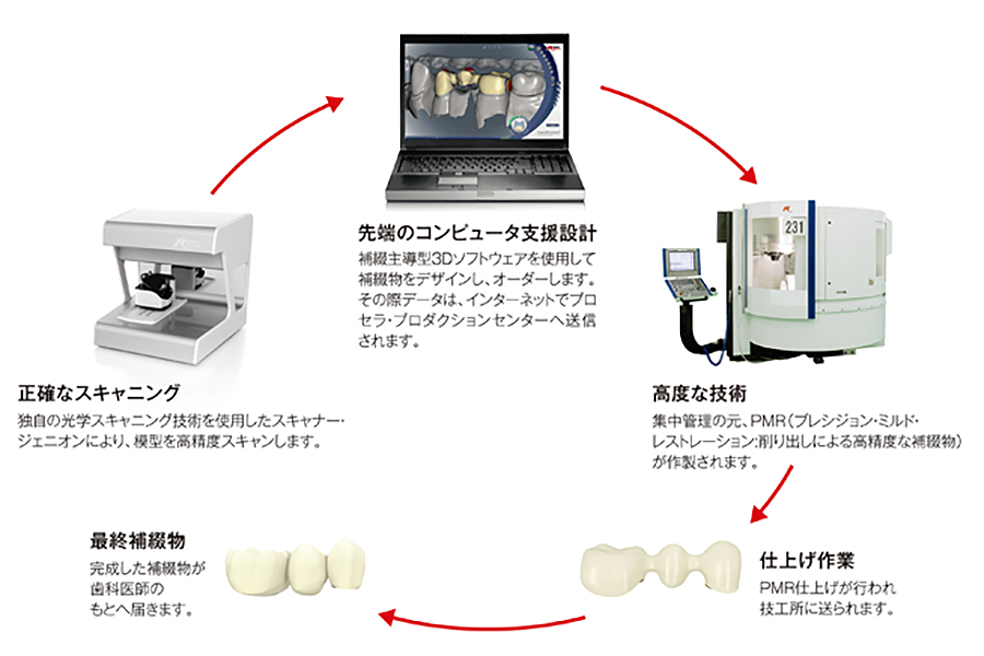 ノーベルプロセラ