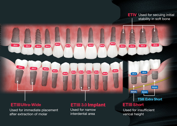 独自のサイズ展開