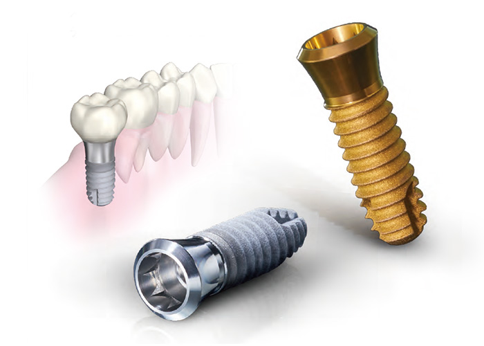 ボーンレベルタイプ
