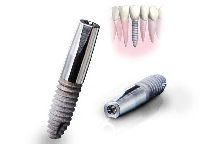 ボーンレベルタイプ