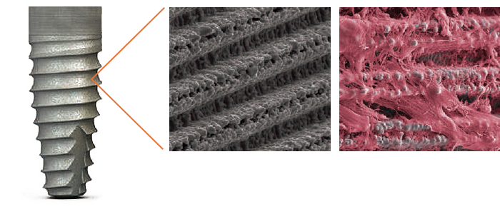 Laser-Lok