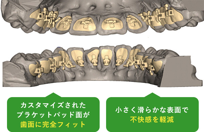 eBrace（イーブレース）