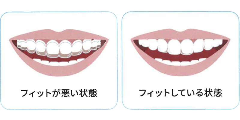 計画通りの治療